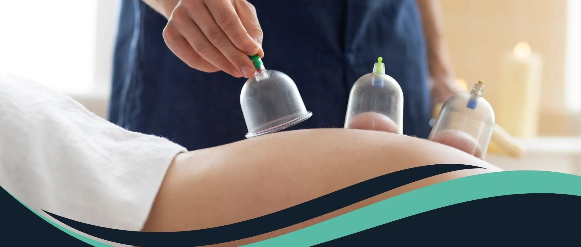 Hacamat Tedavisi ile Doğal Şifanın Gücünü Keşfedin - İzmir Hacamat | Dr. Mehmet Özkent